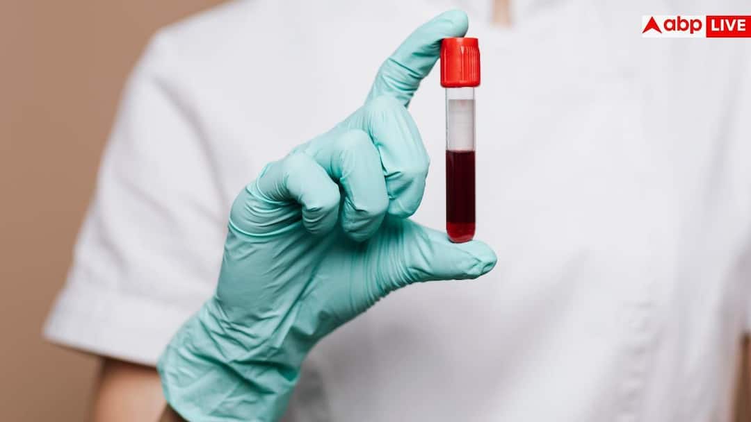 9f20e94d360d4a731f6935b21901a2da17764115240721257 original